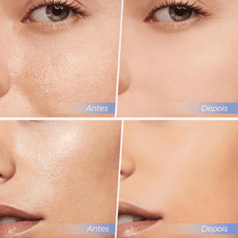 Pó Facial Anti-Rugas e Anti-Oleosidade - SACE LADY [Compre 1 & Leve 2] + Brindes