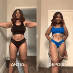 BelleLift Sculpt™ – Tecnologia 3 em 1 Contra Flacidez, Celulite e Estrias