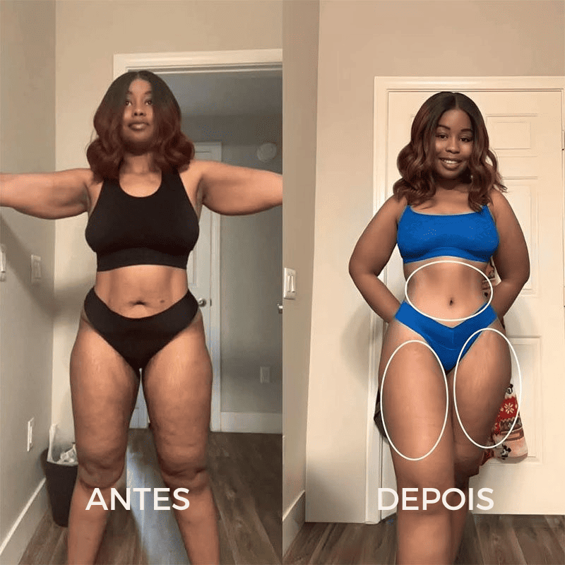 BelleLift Sculpt™ – Tecnologia 3 em 1 Contra Flacidez, Celulite e Estrias