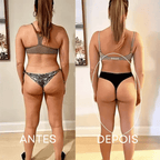 BelleLift Sculpt™ – Tecnologia 3 em 1 Contra Flacidez, Celulite e Estrias