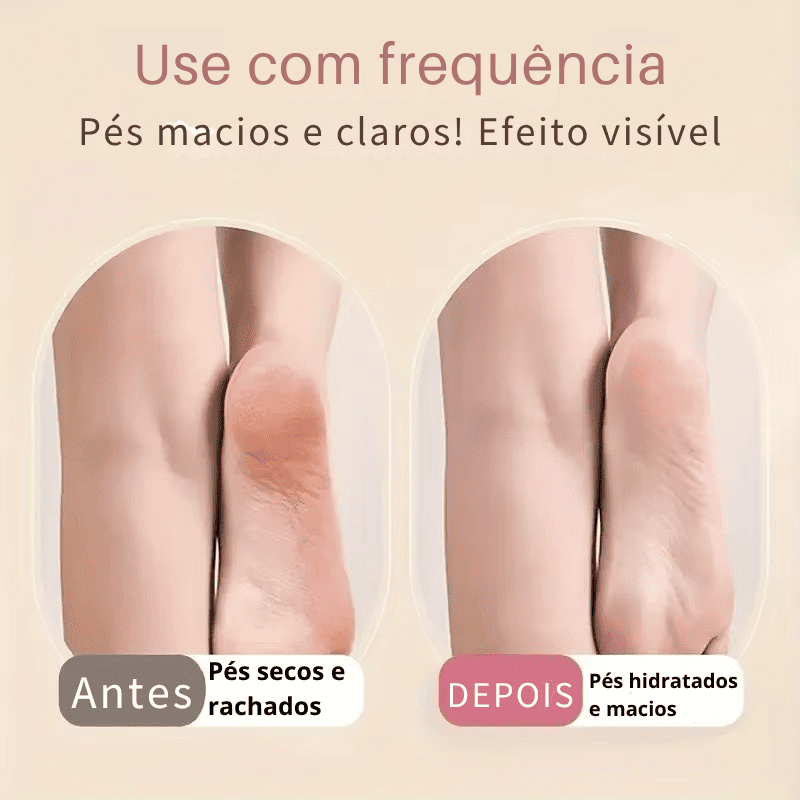 BelleCare – Meias Hidratantes Anti-Rachaduras para os Pés