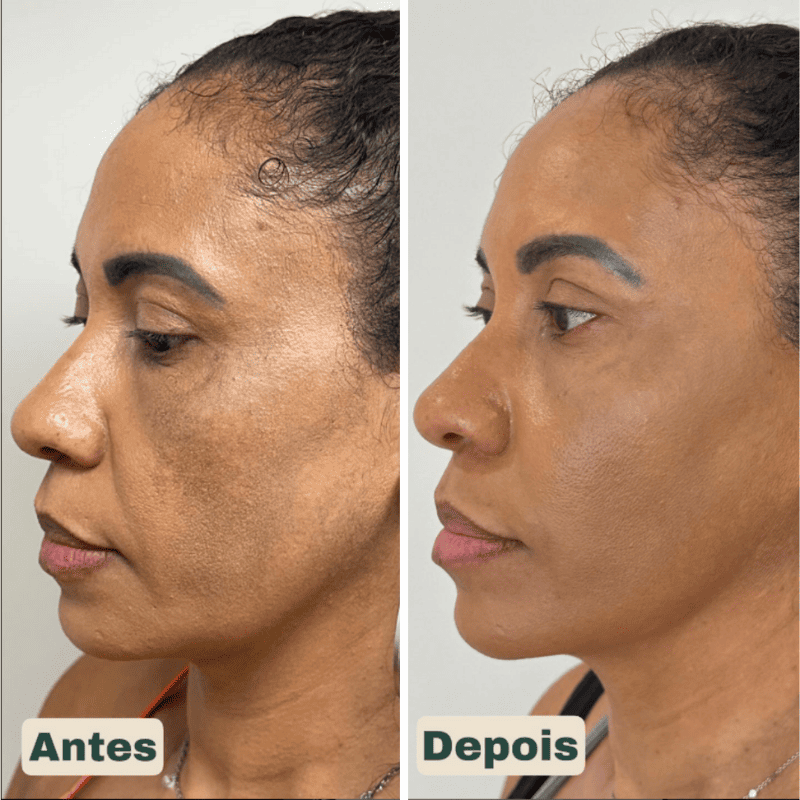 CollageSkin – Máscara Anti-idade com Efeito Lifting