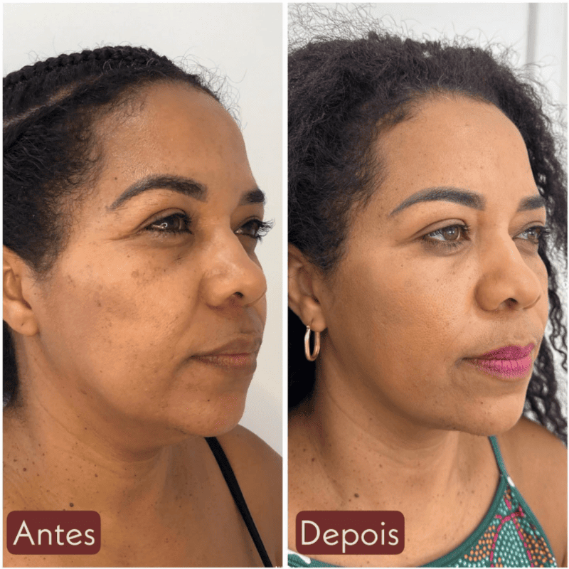 CollageSkin – Máscara Anti-idade com Efeito Lifting