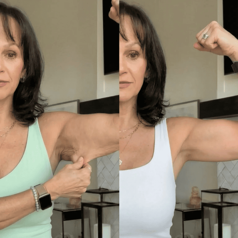 BelleLift Sculpt™ – Tecnologia 3 em 1 Contra Flacidez, Celulite e Estrias