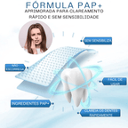 SmileKit – Clareamento total em 30 minutos