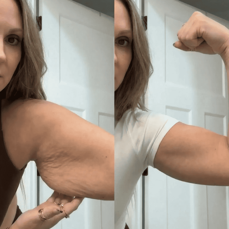 BelleLift Sculpt™ – Tecnologia 3 em 1 Contra Flacidez, Celulite e Estrias