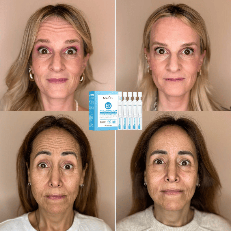 DermaGlow - Sérum de Ácido Hialurônico em Gotas